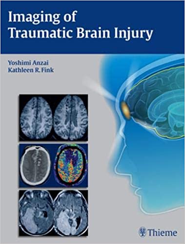 Imaging of Traumatic Brain Injury » Medical Book Store Pakistan