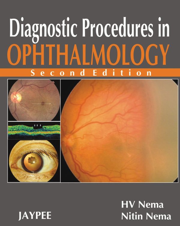 Diagnostic Procedures in Ophthalmology 2nd Edition