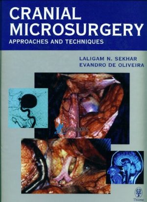 Cranial Microsurgery Approaches and Techniques