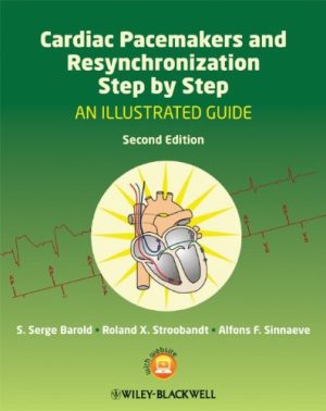 Cardiac Pacemakers and Resynchronization Step by Step An Illustrated Guide 2nd Edi