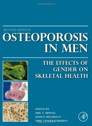 Osteoporosis in Men The Effects of Gender on Skeletal Health 2nd Edition