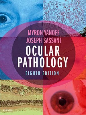 Ocular Pathology 8th Ed