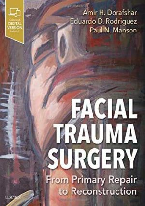 Facial Trauma Surgery From Primary Repair to Reconstruction