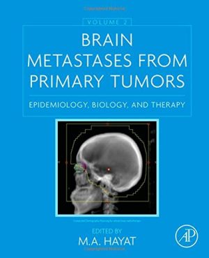 Brain Metastases from Primary Tumors Volume 2 Epidemiology Biology and Therapy