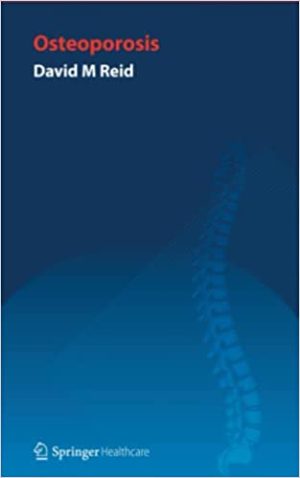 Handbook of Osteoporosis