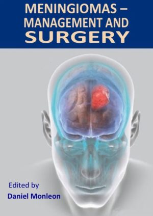 Meningiomas Management and Surgery
