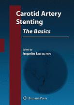 Carotid Artery Stenting The Basics