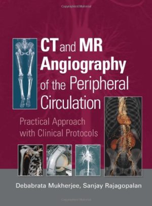 CT and MR Angiography of the Peripheral Circulation Practical Approach with Clinical Protocols