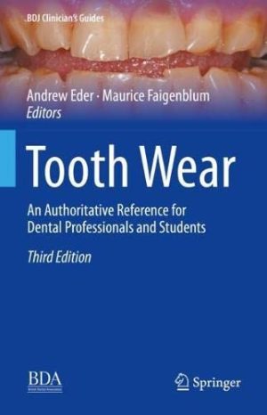 Tooth Wear An Authoritative Reference for Dental Professionals and Students 3rd Edition