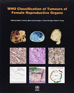 WHO Classification of Tumours of the Female Reproductive Organs 4th Edition