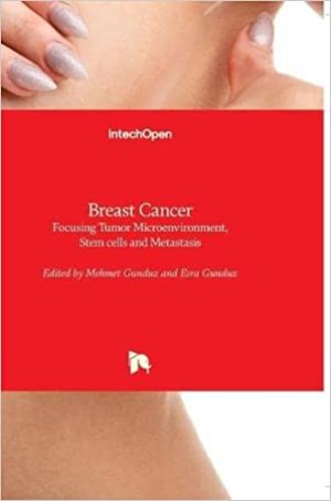 Breast Cancer Focusing Tumor Microenvironment Stem cells and Metastasis