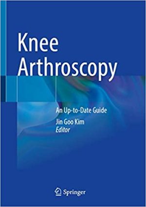 Knee Arthroscopy An Up to Date Guide