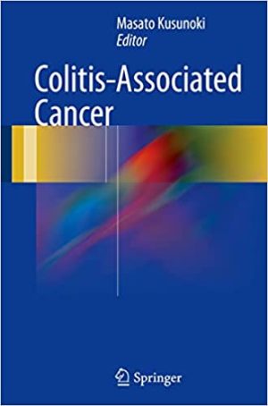 Colitis Associated Cancer
