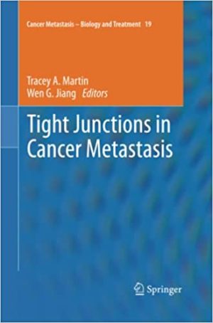 Tight Junctions in Cancer Metastasis