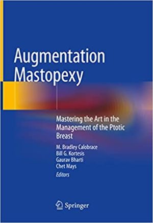 Augmentation Mastopexy Mastering the Art in the Management of the Ptotic Breast