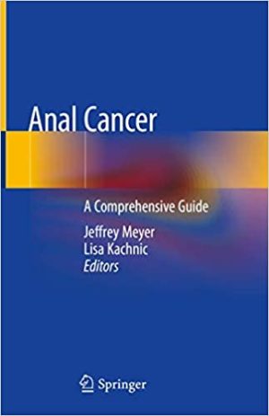 Anal Cancer A Comprehensive Guide