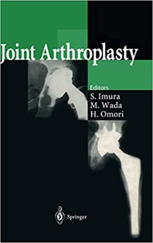 Joint Arthroplasty By Noriya Akamatsu