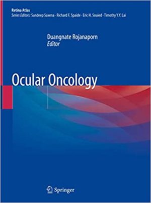 Ocular Oncology By Duangnate Rojanaporn