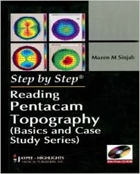 Step By Step Reading Pentacam Topography