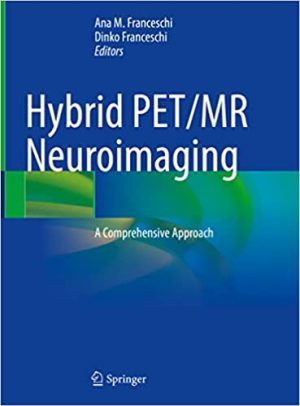 Hybrid PET MR Neuroimaging A Comprehensive Approach