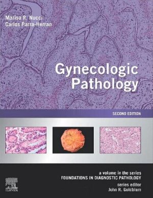 Gynecologic Pathology A Volume in Foundations in Diagnostic Pathology Series