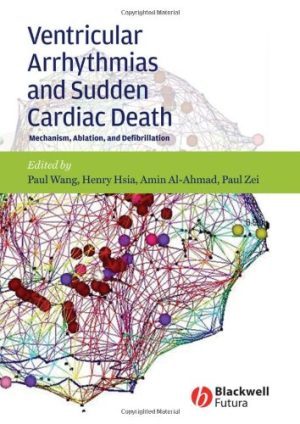 Ventricular Arrhythmias and Sudden Cardiac Death Mechanism Ablation and Defibrillation