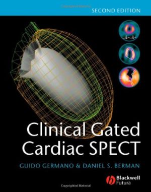 Clinical Gated Cardiac SPECT 2nd Ed