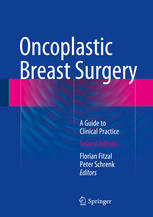 Oncoplastic Breast Surgery A Guide to Clinical Practice 2nd Edition