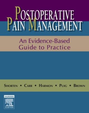 Postoperative Pain Management An Evidence Based Guide to Practice
