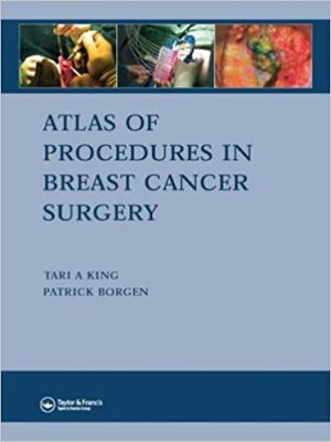 Atlas of Procedures in Breast Cancer Surgery