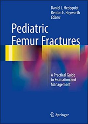 Pediatric Femur Fractures A Practical Guide to Evaluation and Management