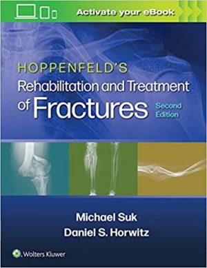 Hoppenfelds Treatment and Rehabilitation of Fractures 2nd Ed