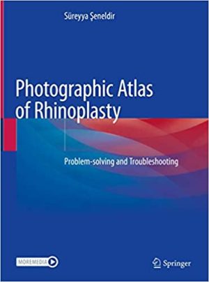 Photographic Atlas of Rhinoplasty Problem solving and Troubleshooting