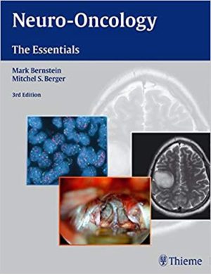 Neuro Oncology The Essentials 3rd Edition