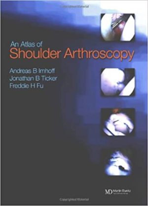 Atlas of Shoulder Arthroscopy