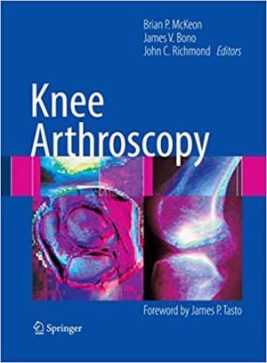 Knee Arthroscopy