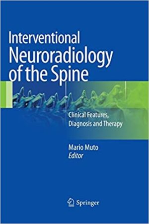 Interventional Neuroradiology of the Spine Clinical Features Diagnosis and Therapy