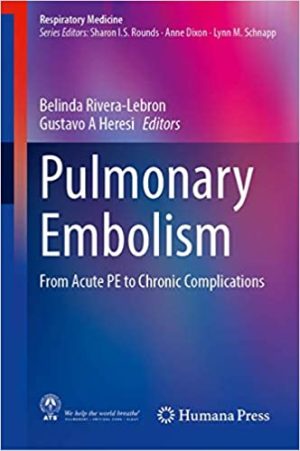 Pulmonary Embolism From Acute PE to Chronic Complications