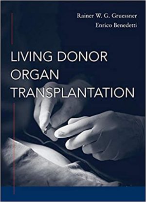 Living Donor Organ Transplantation