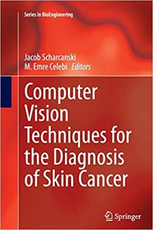 Computer Vision Techniques for the Diagnosis of Skin Cancer