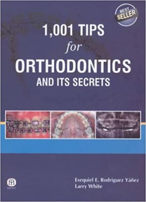 1001 Tips for Orthodontics and its Secrets