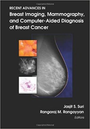 Recent Advances in Breast Imaging Mammography and Computer Aided Diagnosis of Breast Cancer