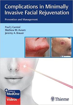 Complications in Minimally Invasive Facial Rejuvenation Prevention and Management
