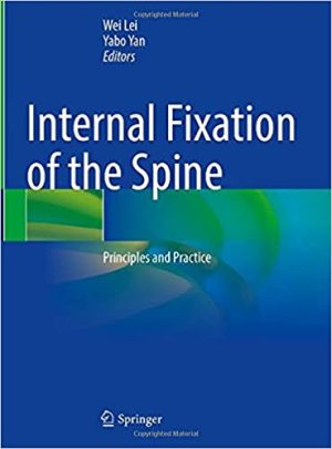 Internal Fixation of the Spine Principles and Practice