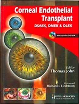 Corneal Endothelial Transplant