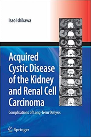 Acquired Cystic Disease of the Kidney and Renal Cell Carcinoma