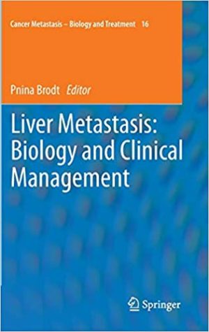 Liver Metastasis Biology and Clinical Management