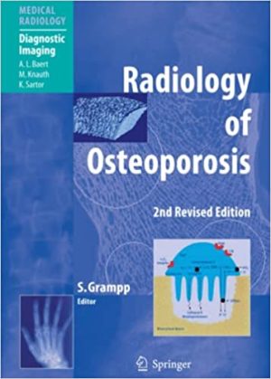 Radiology of Osteoporosis 2nd Edition