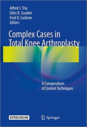 Complex Cases in Total Knee Arthroplasty A Compendium of Current Techniques