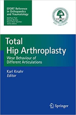 Total Hip Arthroplasty Wear Behaviour of Different Articulations